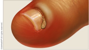 Description: illustration