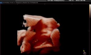 Будущий малыш – видим по-настоящему с Realistic Vue