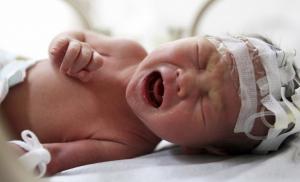 Ребенка спасли при помощи суперклея