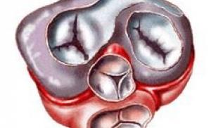 Раньше врачи прикладывали уши к сердцу, чтобы прослушать бой сердца