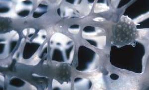 Пост-менопауза