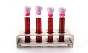 Разработан новый быстрый способ анализа крови