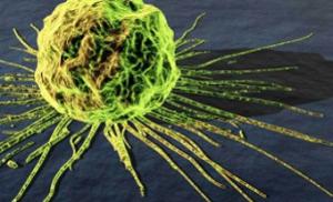  По утверждению биологов рак - это новый развивающийся вид паразитов.