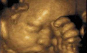 Дети учатся плакать еще в утробе матери